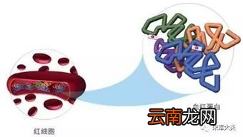 糖化不高血糖高怎么回事,糖化血糖不高餐后血糖高是不是糖尿病