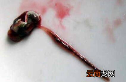虾头怎么清洗