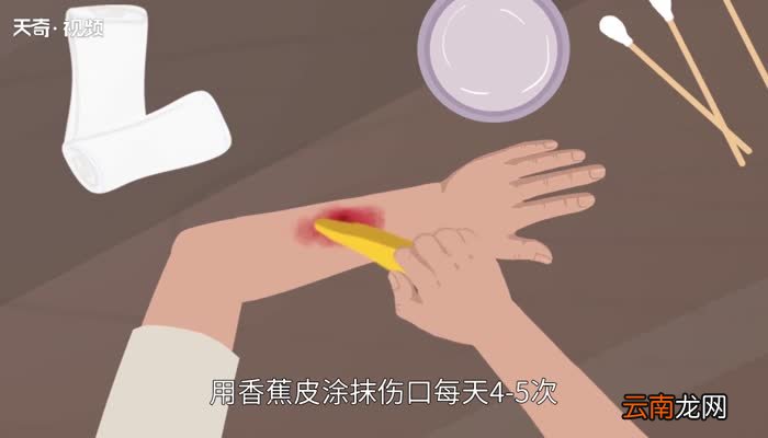 香蕉皮能吃吗 香蕉皮可以吃吗