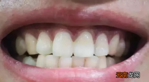 保护牙齿的标语，儿童保护牙齿的标语