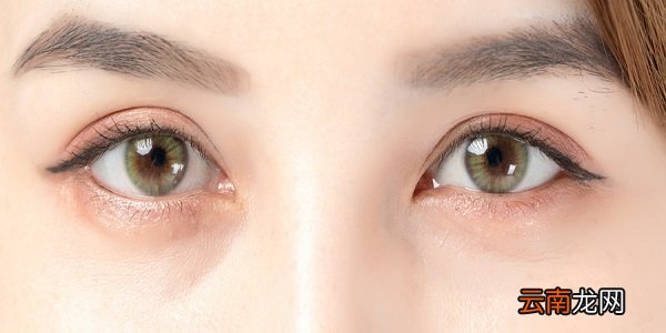 经常带隐形眼镜会怎样 长期戴隐形眼镜有什么危害