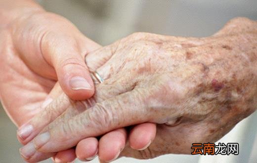 老人如何去除手部的老年斑