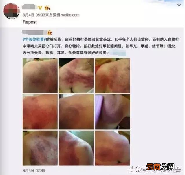 这不是养生，是找病！