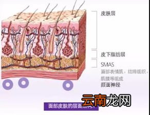 肌筋膜祛皱有副作用吗,脸上除皱之后有副作用吗？