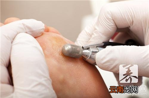 脸部如何快速去角质的方法 DIY去角质更彻底