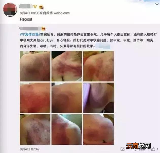 「健康」如此“养生”不可取!