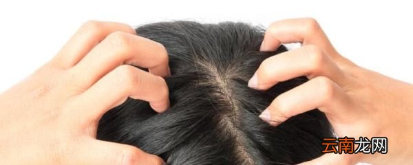 头皮屑多是什么原因 头皮屑多是什么原因引起的