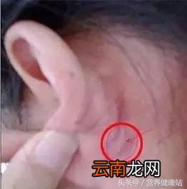 耳后一个窝，专门降糖调血！每天按10秒钟，好处真神了！
