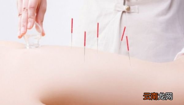 拔罐多久可以洗热水澡拔罐后需要等多久才能洗澡