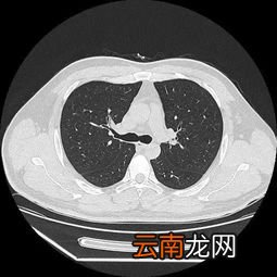 做一次ct对人体伤害有多大,ct对人体的伤害有多大？