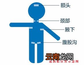 心梗为什么发烧40度,心肌梗死患者为什么会发烧