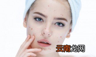 用隔离和不用隔离的区别? 用隔离和不用隔离的区别是什么