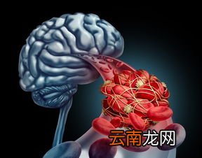 脑梗用溶栓治疗效果好吗,溶栓治疗用于什么