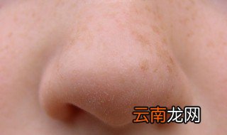 粉刺怎么去除小妙招生活中 粉刺去除小妙招
