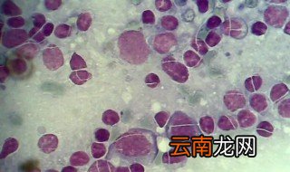 骨髓的作用 骨髓的作用是什么