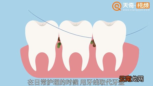 门牙有缝怎么办
