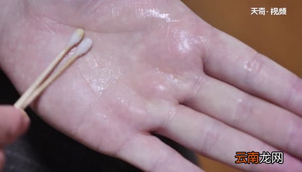 酒精消毒方法 怎么用酒精消毒