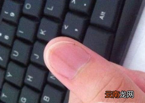 大拇指指甲上有竖纹是怎么回事?