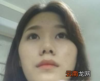 额头有异骨- 面相额头骨头突出