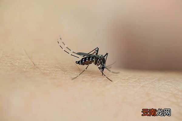 怎样去除蚊子咬的痕迹 蚊虫叮咬痕迹怎么去掉