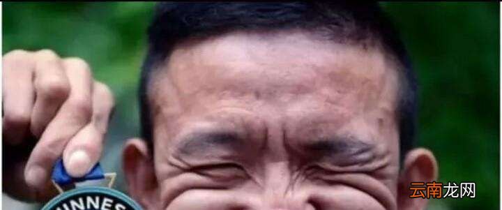 世界上最丑的人