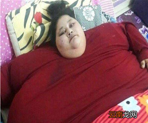世界最胖的女人