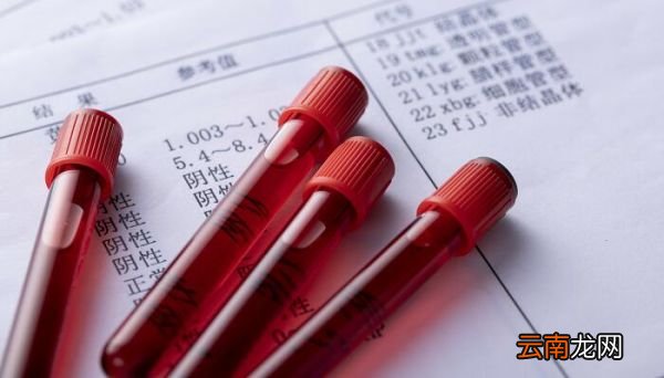 血液凝固的基本过程 简述血液凝固的基本过程