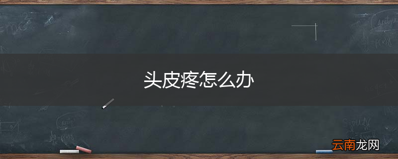 头皮疼怎么办