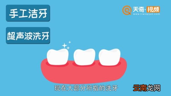 洗牙多少钱 洗牙多少钱一般