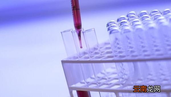 铝单质与氢氧化钠溶液反应的方程式 铝单质与氢氧化钠溶液反应的方程式是什么