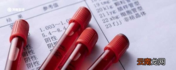 做核酸检测前需要注意什么 核酸检测前的注意事项