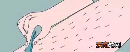 女生腿毛怎么永久去除