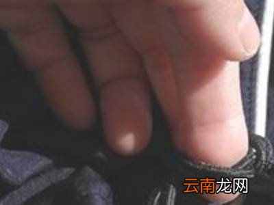 裤脚的收缩绳怎么绑