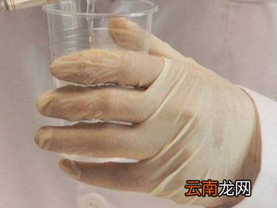老鼠贴的胶怎么去除