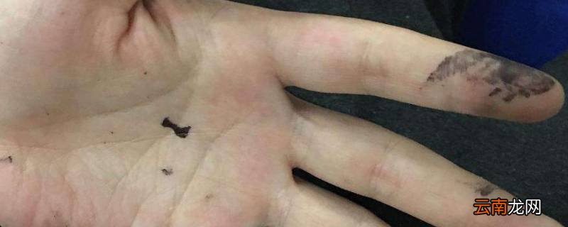 染发膏把手指染黑了怎么清洗
