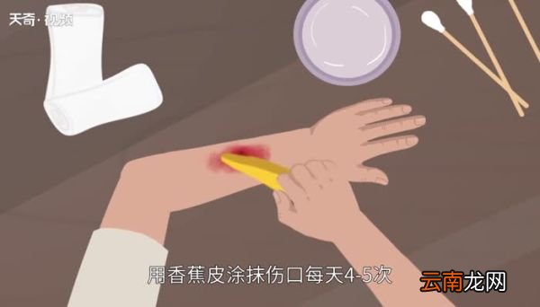 香蕉皮能吃吗 香蕉皮可以吃吗