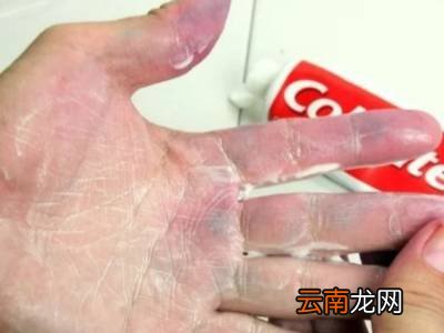 五贝子染发剂弄到皮肤上怎么洗掉