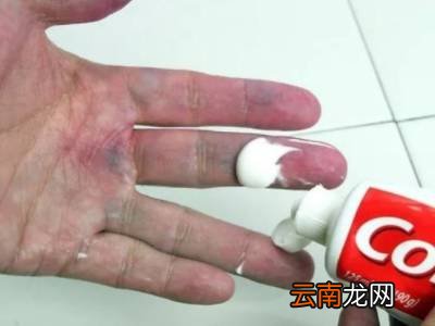 五贝子染发剂弄到皮肤上怎么洗掉