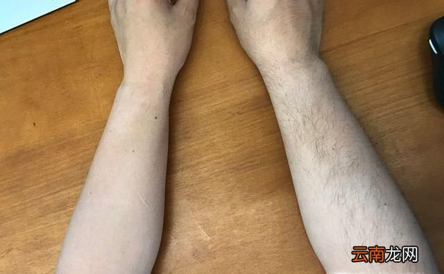 用脱毛膏的利弊