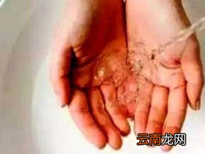 黑色染发剂弄到指甲上怎么洗掉
