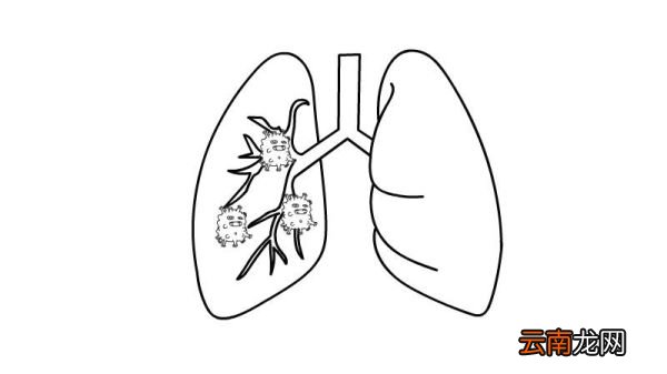 肺炎简笔画