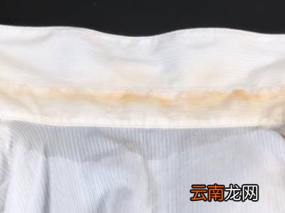 衬衣领子发黄怎么洗小窍门
