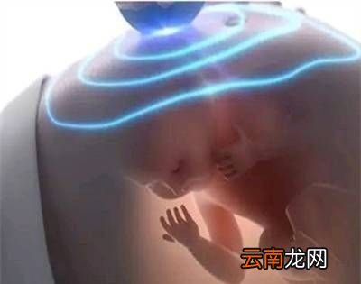 羊水为什么叫羊水？