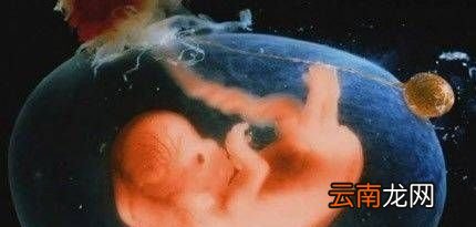 羊水为什么叫羊水？