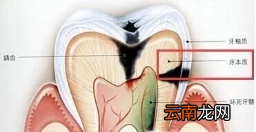 图解 牙齿的结构