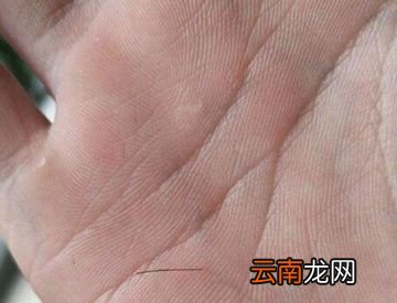 头发能不能扎进肉里？