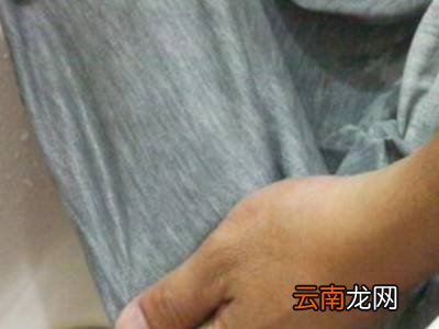 碘酒怎么洗掉