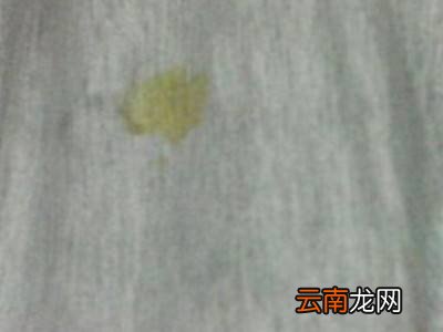 碘酒怎么洗掉