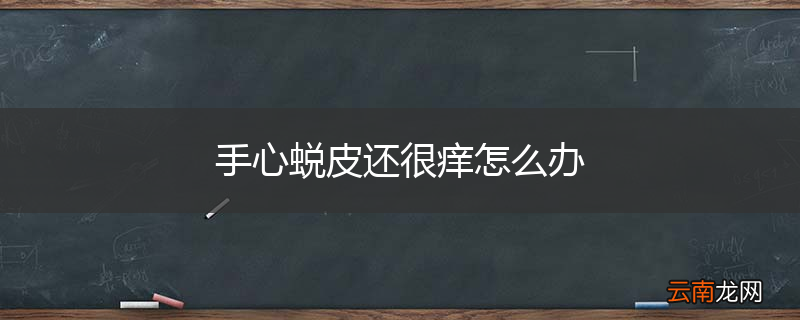 手心蜕皮还很痒怎么办