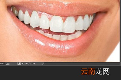 PS牙齿如何变白 变白方法推荐